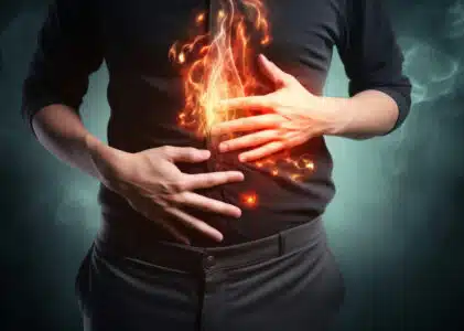 Acid Reflux and Hemorrhoids: Deadly Duo